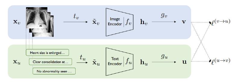 Featured image of post Contrastive Learning of Medical Visual Representations From Paired Images and Text论文速读