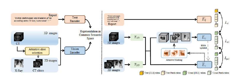 Featured image of post Unified Medical Image Pre Training in Language Guided Common Semantic Space论文速读